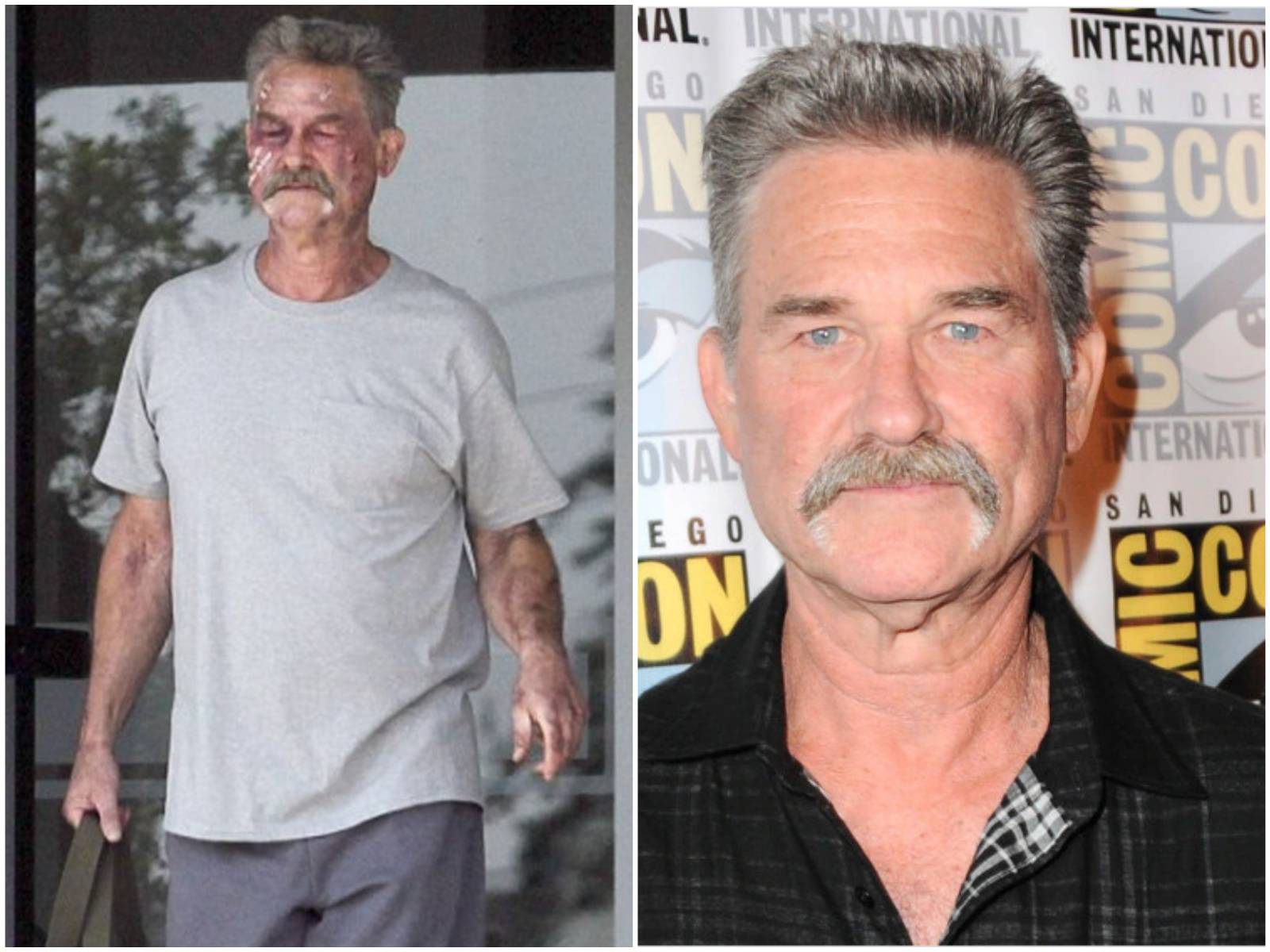 Kurt Russell had what medical conditions? VORIHEI