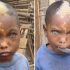 Little boy with natural blue eyes, white hairs and lightning mark down his face goes viral