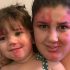 Mom paints face to look like daughter’s heart-shaped port wine birthmark